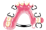 部分入れ歯